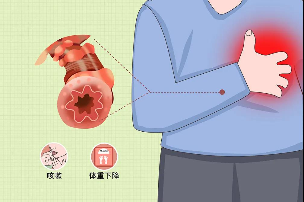 类风湿对肺的影响,类风湿引起肺部感染怎么办