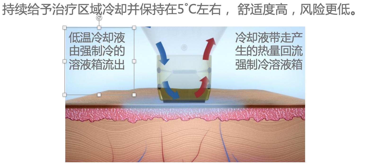 为了亲眼看到龚俊我的脸差点毁了，做了光子嫩肤，护理必须要上心