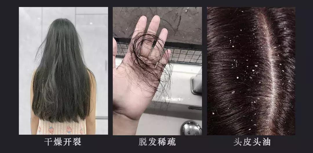 挑战3天不洗头依然干爽不油腻,4天不洗头头发就油了正常吗