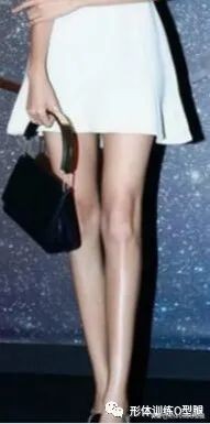 怎样矫正o型腿罗圈腿,罗圈腿和o型腿是怎么形成的