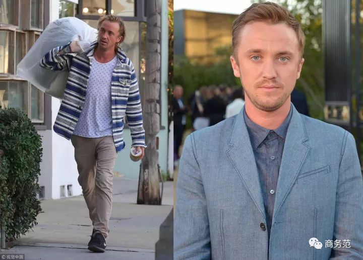 威廉王子秃顶了哈里为啥没秃顶,威廉王子为什么喜欢秃顶