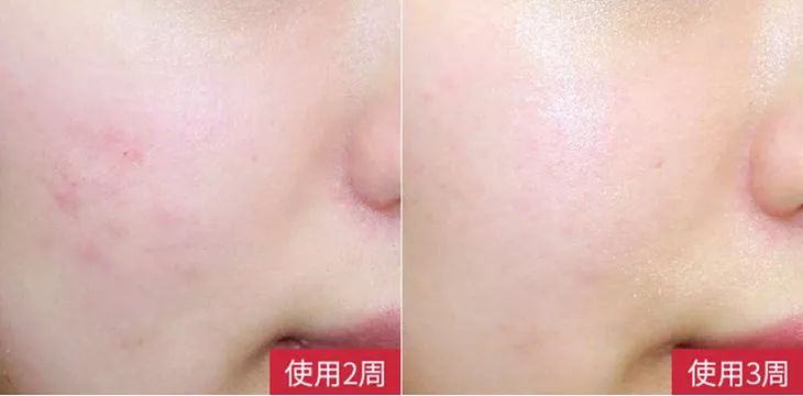 李湘代言美容仪,李湘护肤视频