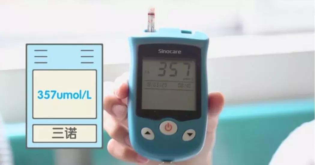 痛风检测仪器有用吗,痛风患者如何选购尿酸测试仪器