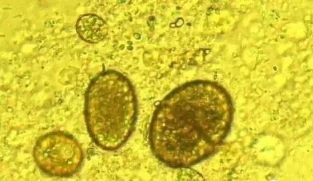 水中常见的绿藻,列举哪些常见藻类是绿藻