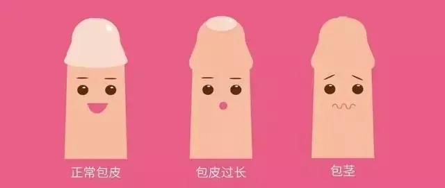 （女生慎入）男性这些情况，包皮必须割