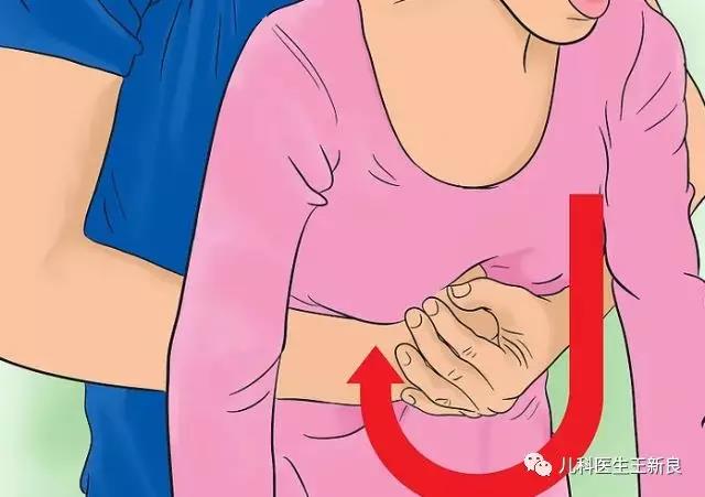 异物卡喉快用海姆立克法抢救,异物卡喉海姆立克急救方法