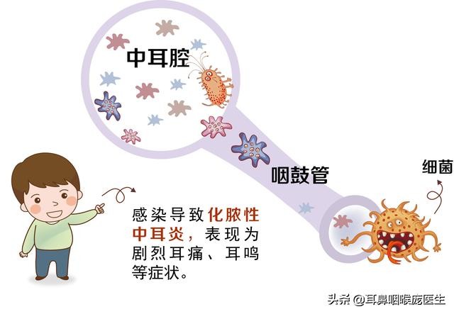 鼻炎导致耳朵闷是怎么回事,鼻炎出现耳闷是严重了吗