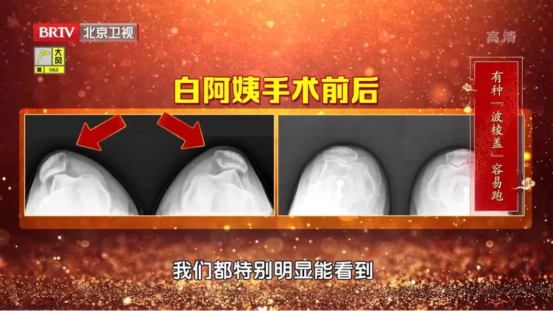跑步怎么样才能避免膝关节磨损,2个小动作帮助延长膝盖寿命