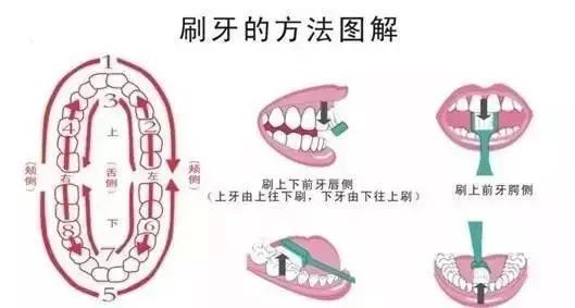 为什么现在的小孩子容易长蛀牙,经常吃糖的小孩蛀牙会成什么样