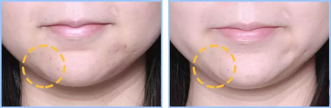 既能美白又抗老,既能美白又能抗衰老的护肤品