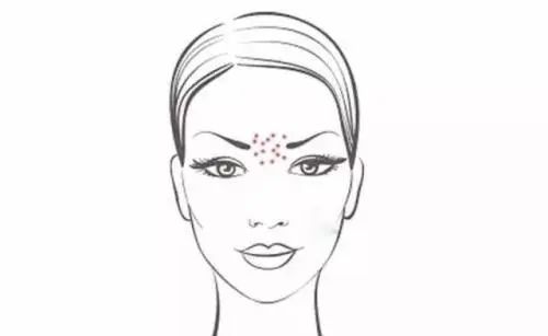 脸上老是长痘怎样内调,脸上老是长痘怎么办小妙招