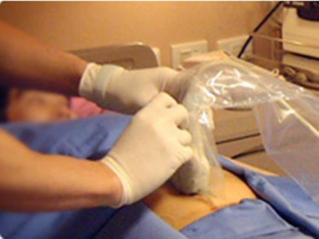 唐筛高风险一定要做羊水穿刺,二胎唐氏筛查结果高风险