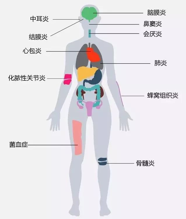 4岁要接种hib疫苗,hib疫苗成人可以接种吗