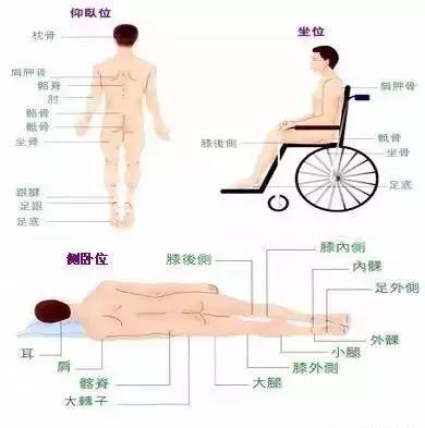 压疮的十大误区,怎样才能让压疮好得快