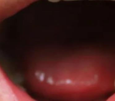 又上火了怎么回复,急火上火