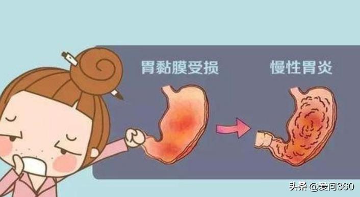 保护胃黏膜修复胃粘膜 (胃黏膜受损如何修复胃黏膜)