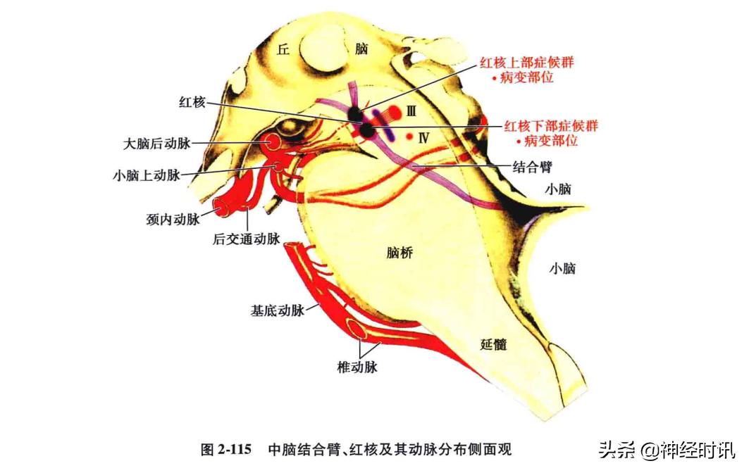 脑干解剖,脑干神经解剖