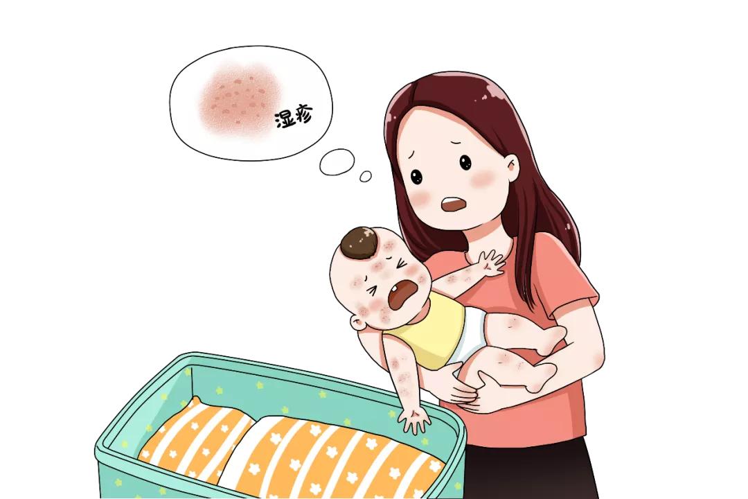 宝宝湿疹应该忌口什么,外阴湿疹好了以后还用忌口吗