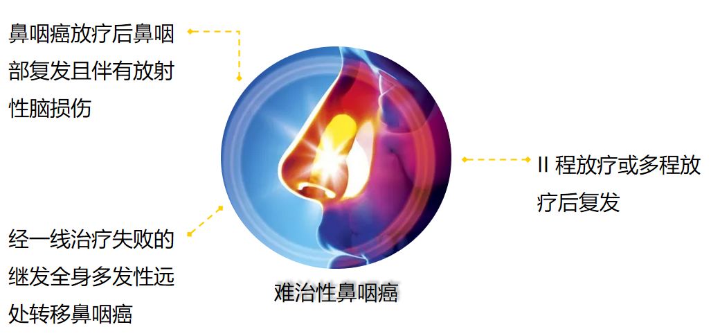 挑战不可能老兵退役,挑战不可能老兵系列