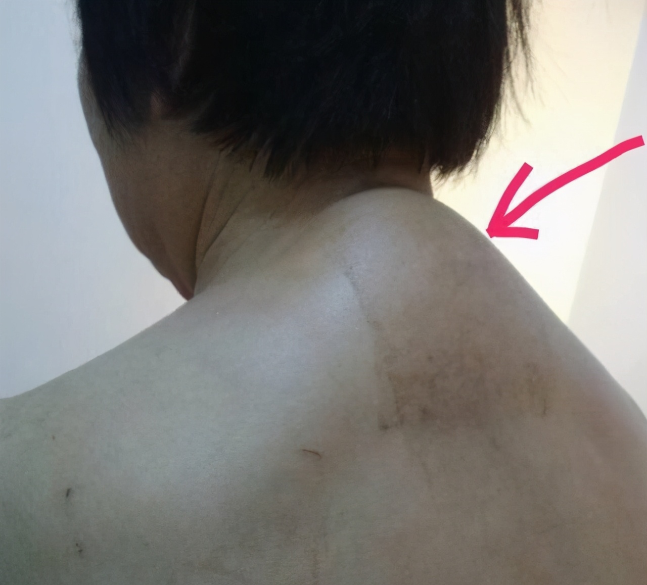 长了富贵包如何消除掉,富贵包消除的最佳运动