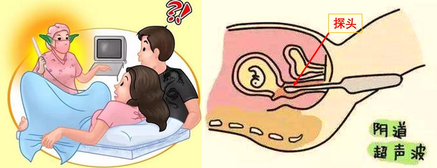 入职体检128的套餐主要体检哪些,28岁已婚女性体检套餐该怎么选择