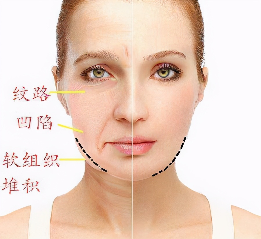 咬肌型发腮怎么改善,大脸方脸女生如何快速改变脸型