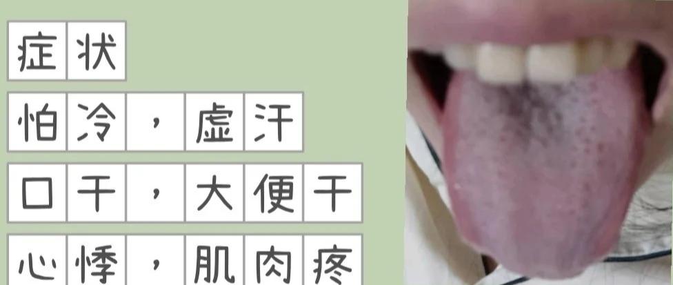 便秘大便干燥像羊便什么原因,便秘但是大便溏稀是怎么回事