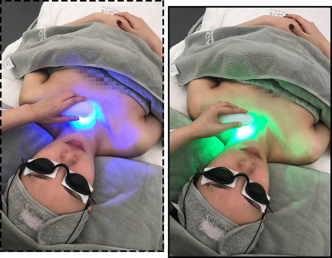 花3000块做一次皮肤护理我后悔吗,皮肤提拉效果怎么样