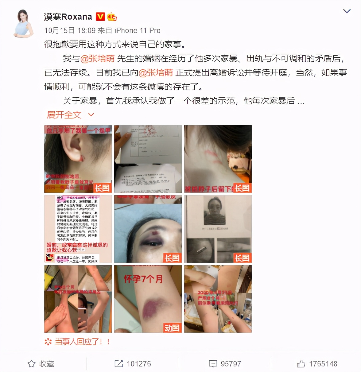 家暴能为了孩子忍让吗,家暴能不能原谅