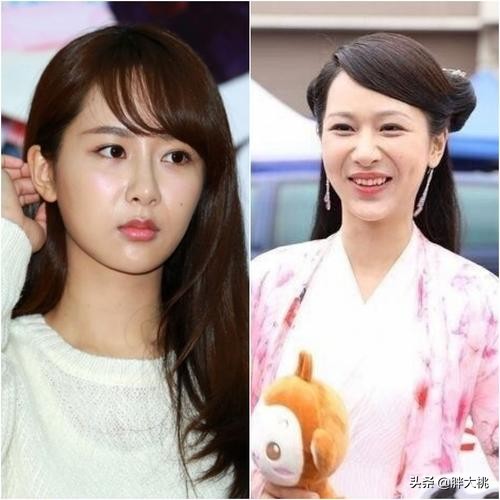 法令纹早出现还是晚出现好,什么样的人不容易长法令纹