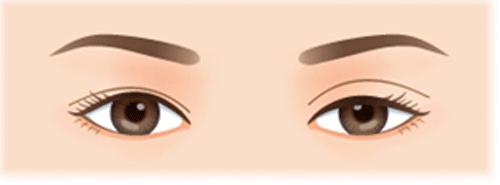 左脸和右脸不一样好看,左脸总比右脸好看