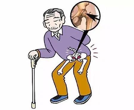 做什么动作有助于股骨头血液循环,换了股骨头哪些动作需要注意