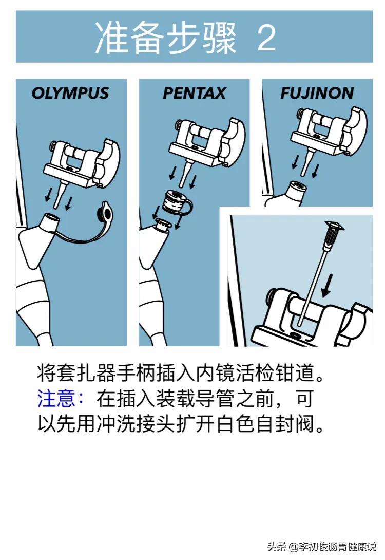 一次无痛胃肠镜一共需要多久,一次做完胃肠镜