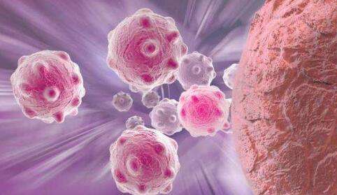 小细胞肺癌是指小结节吗,小细胞肺癌是肺细胞癌变吗