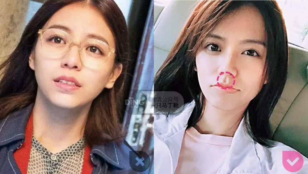 凸嘴微笑练习方法表情管理,前凸嘴怎么做表情管理