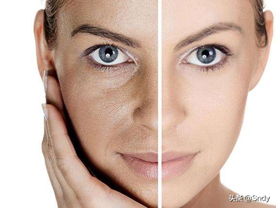 在海边更容易晒黑的原因,在海边晒黑了怎么办