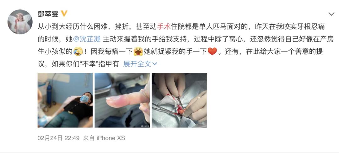 倒刺怎么去除最快方法,长倒刺怎么去除小妙招