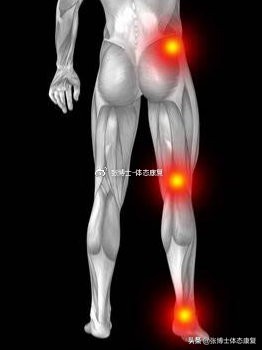 髌骨疼痛综合征的症状与康复思路,髌股关节疼痛综合征怎么快速恢复