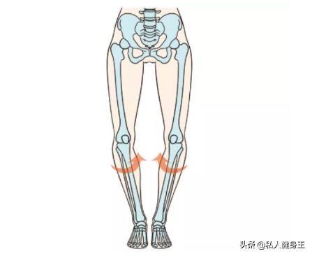 o型腿怎么改善效果最好,怎么样改善o型腿又快又有效