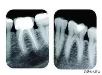 16位牙医自曝内幕看牙警惕哪些,牙医看牙时在想什么