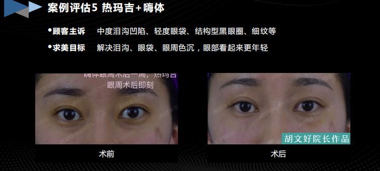 胶生灌养眼周抗衰是什么产品?