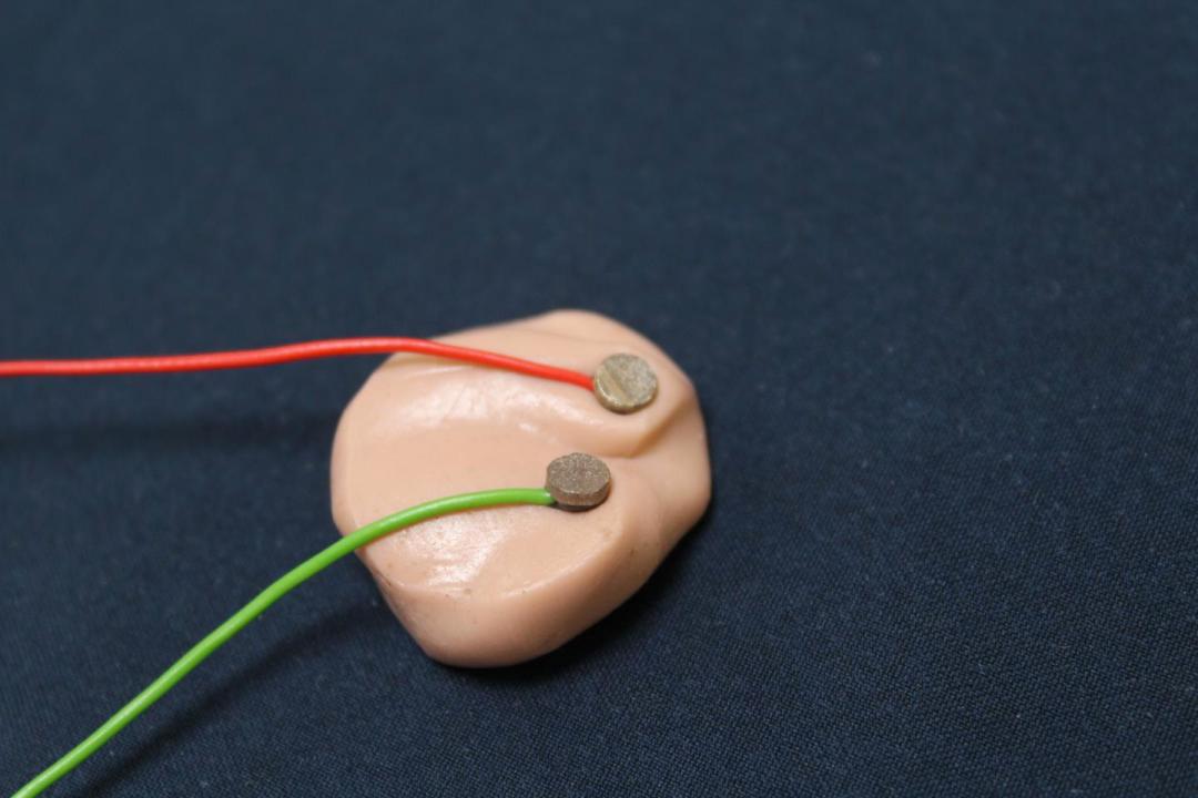 脑科学治自闭症有突破吗,脑科学日报关于记忆