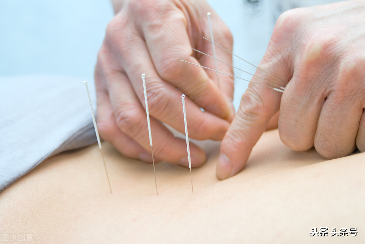 当我遇到他，我才知道，原来针灸可以变成一种享受