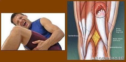 所有肌肉紧张都能靠拉伸解决,肌肉拉伸为什么越来越紧张