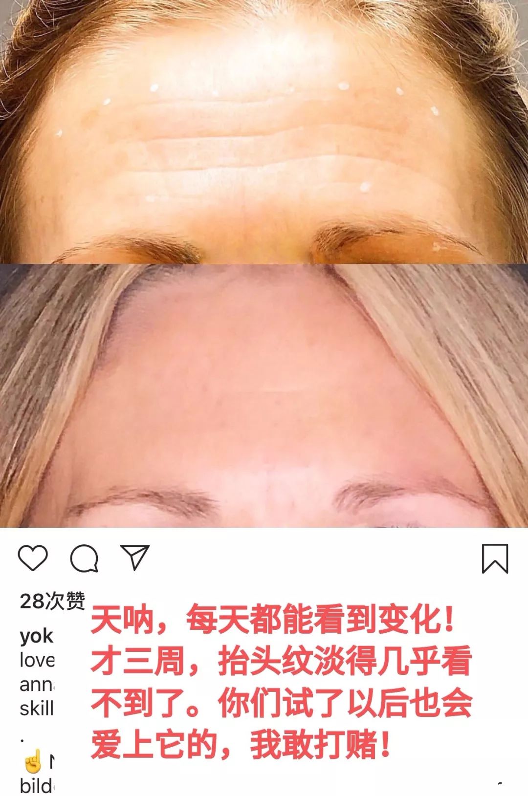 医美让女明星集体回春,女明星医美集体回春