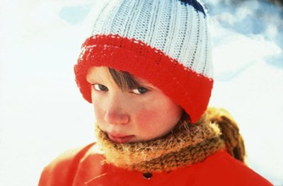 脸上有红血丝怎么办简单方法,脸上有红血丝还出血怎么消除