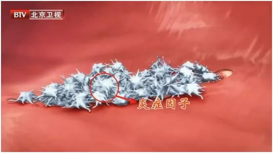 这5种炎症可能会演变成癌症,炎症发展成癌症的几率有多大