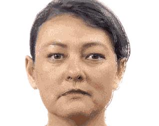 不做医美真的会快速衰老吗,为什么医美使得皮肤衰老更快