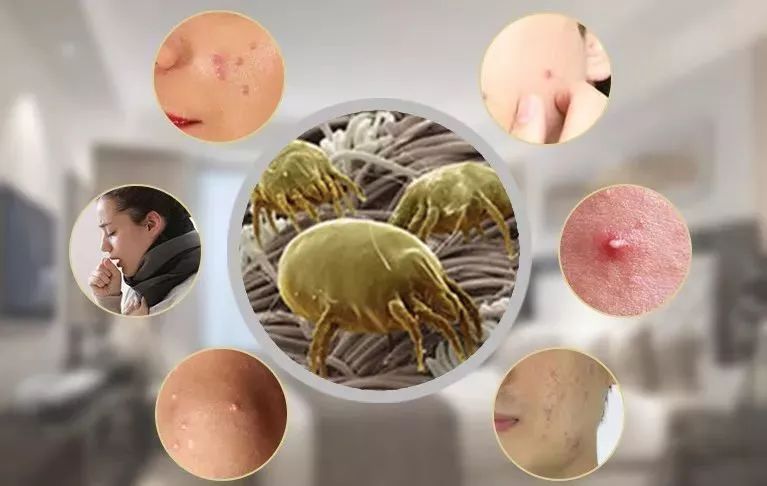 枕芯发霉发黄简单有效的清洗方法,枕芯顽固汗渍发黄怎么洗最有效