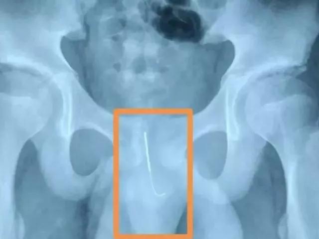 熊孩子玩射箭却意外杀死小女孩,熊孩子玩手雷被军人救了